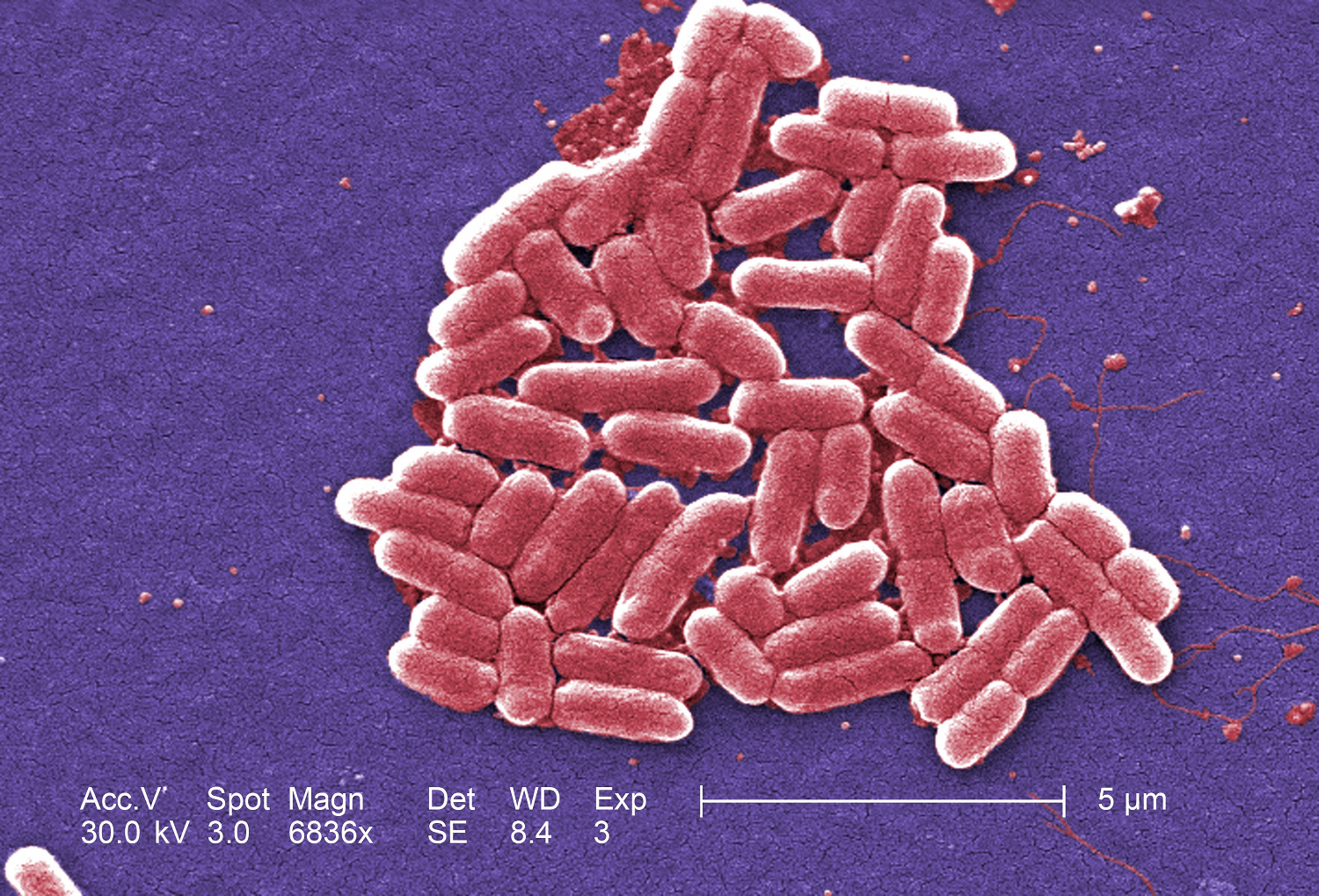 Under a magnification of 6836x, this colorized scanning electron micrograph (SEM) depicted a number of Gram-negative Escherichia coli bacteria of the strain O157:H7, which is one of hundreds of strains of this bacterium. Image by Janice Haney Carr, Centers for Disease Control and Prevention