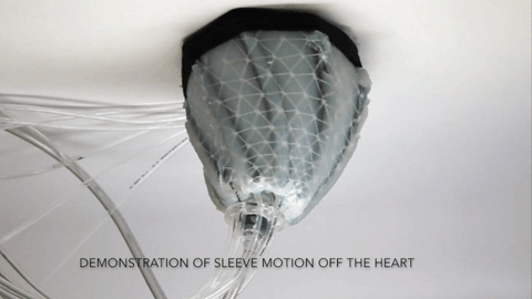 A demonstration of the sequential squeezing and twisting action of the robotic sleeve. Credit: Ellen Roche