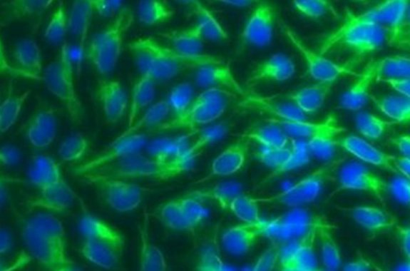 Stem Cells Treat Lou Gehrig’s Disease, In Mice