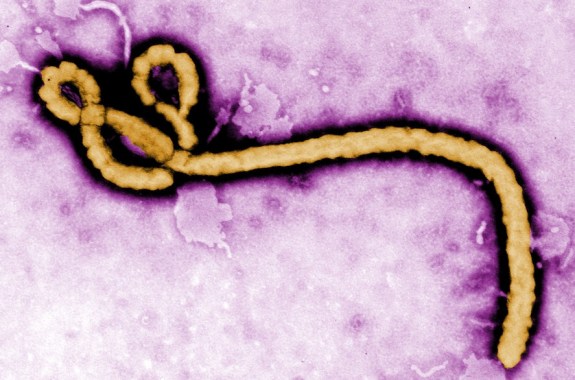 Ebola Outbreak Continues in West Africa