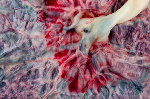 The Hidden Beauty Of The Human Placenta