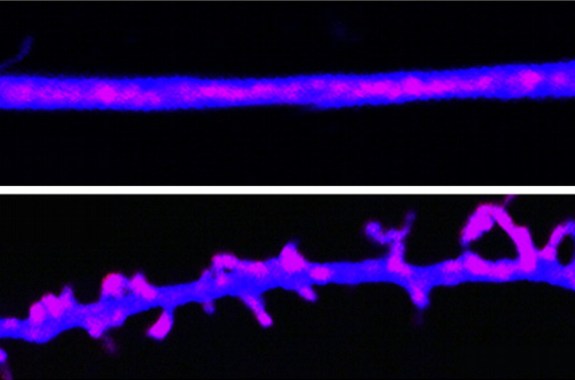 Forget-Me-Not: How Prions Maintain Memory