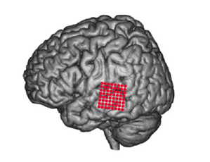 Listening In On The Brain To Decode Speech
