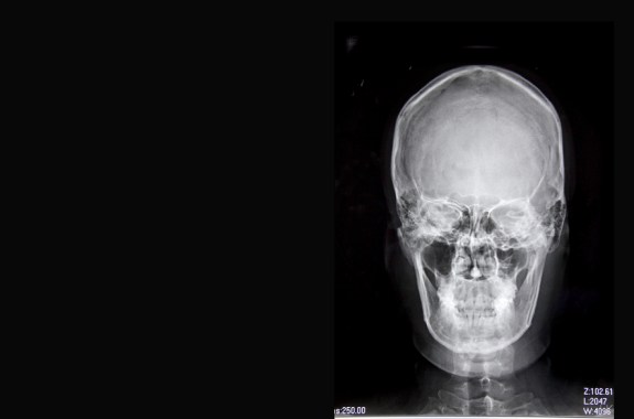 Meet the Brains Behind ‘Bones’