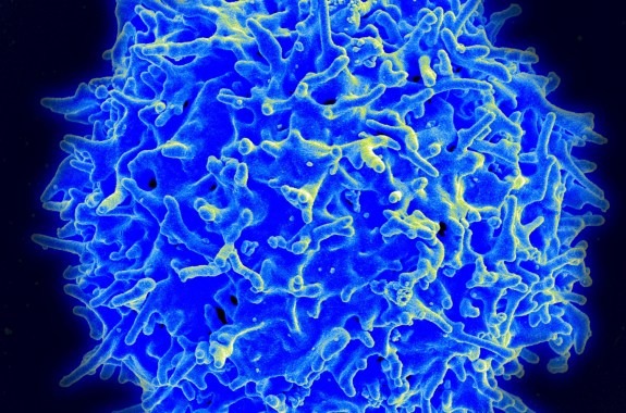 Fighting Cancer With Your Own Immune System