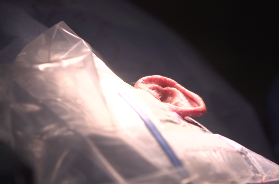 Breakthrough: A Re-Sounding Remedy