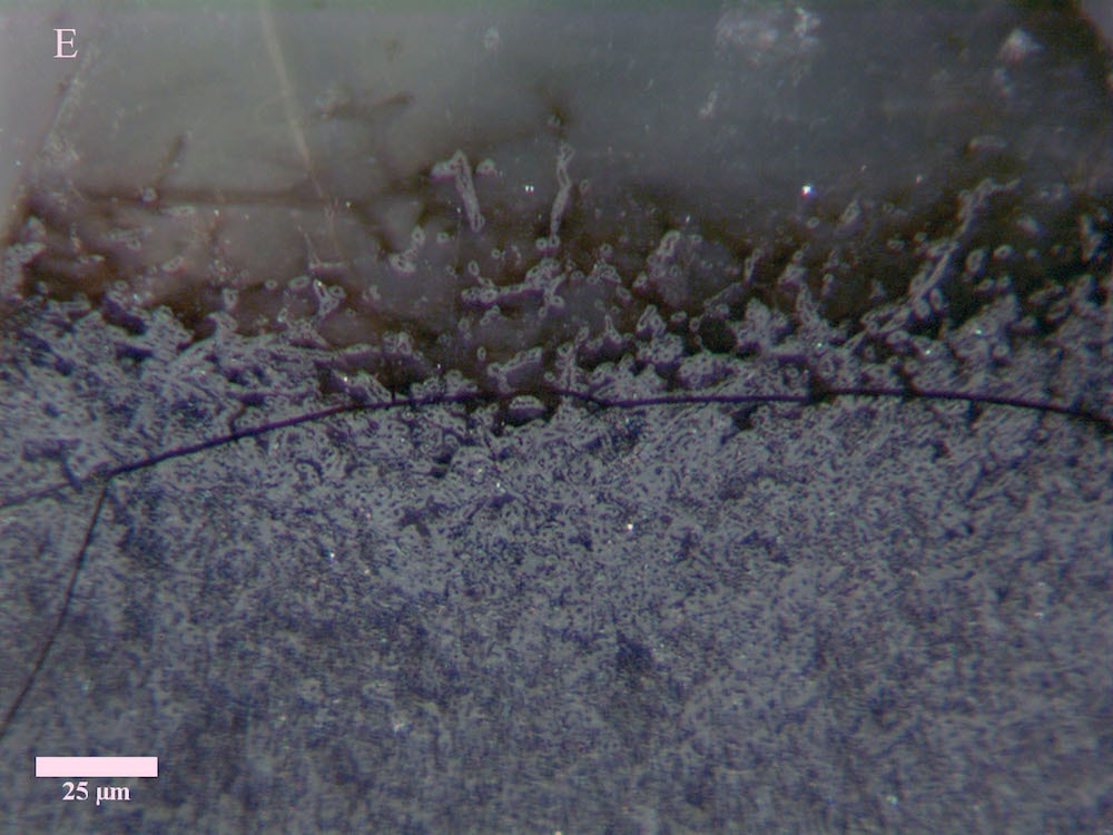 microscopic view of dark gray fungal mycelium 