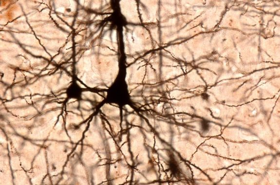 neuron stained under a microscope