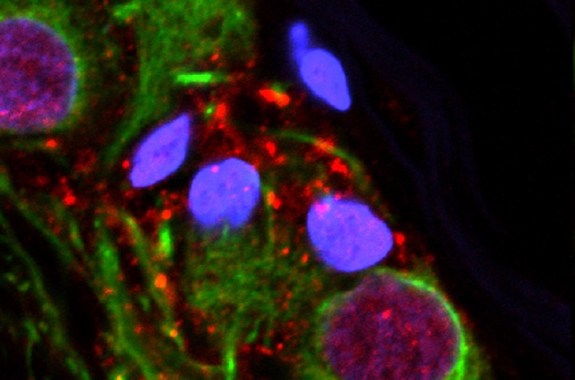 an abstract microscopic image of various green and purple blobs with scattered red dots