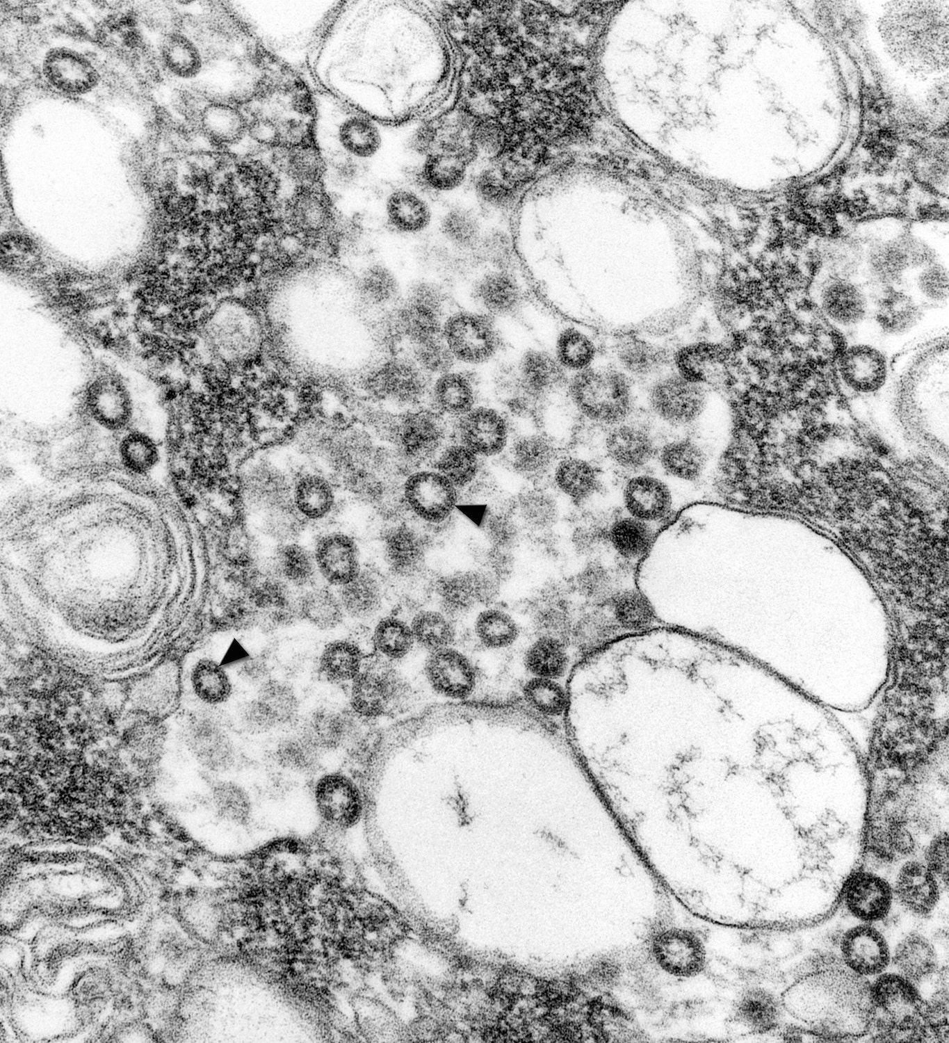 a black and white microscope image that shows many circles. smaller circles with thick black edges (the corona) are the SARS coronavirus.