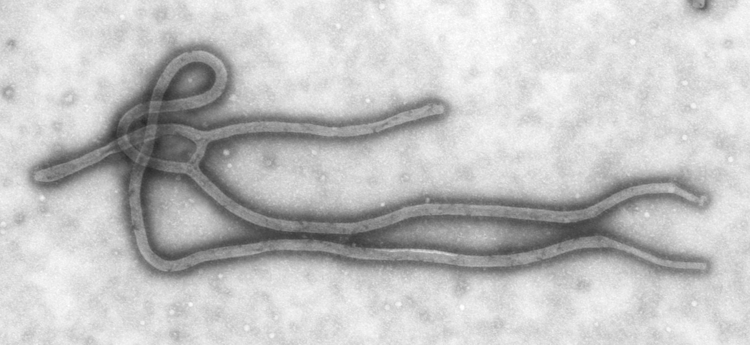an electron microscope image in black and white of an ebola virus, which is long and filamentous and looks like it is tied in a knot