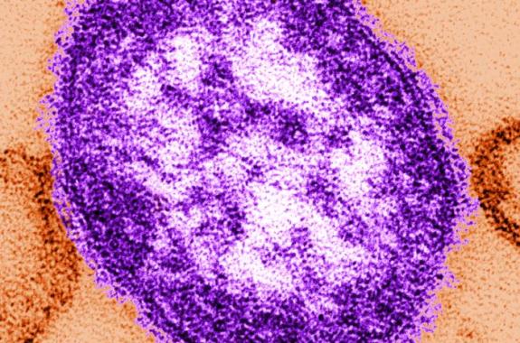 a circular virus that is colored purple on an orange background
