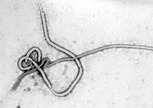 a black and white photo of a thin virus that looks like it is tangled in a knot and elongated to form a hook and staff