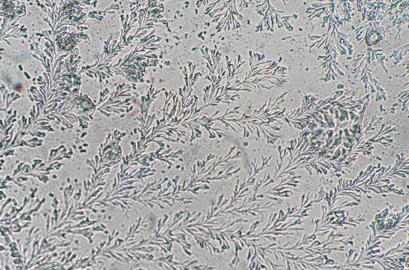 an image from a microscope that shows a full field of beautiful branching shapes that resemble plants or ferns