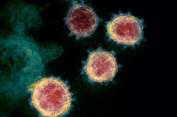 a colored image of circular viruses. the circles are pink in the center and orange on the outside. its edges have small spikes protruding from them