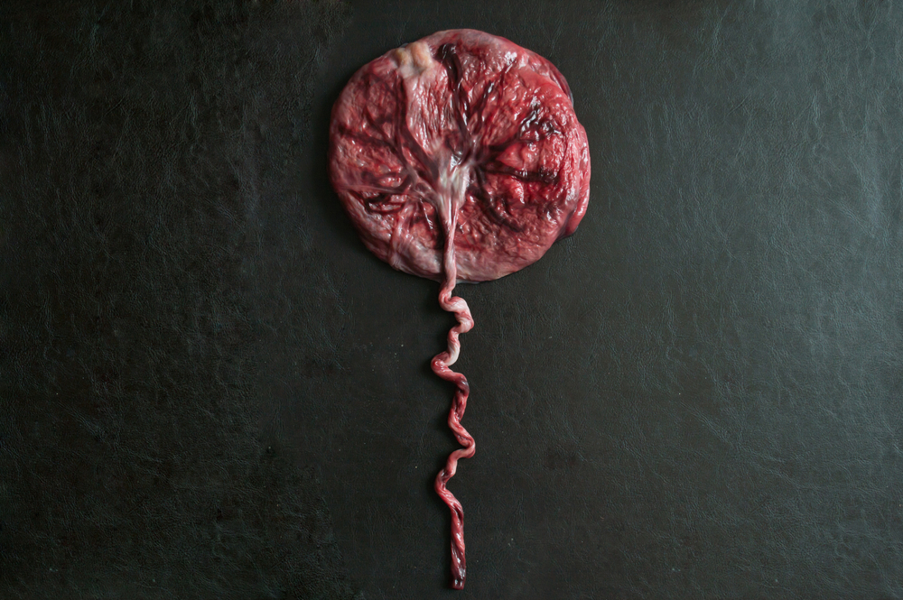 a pancake-shaped placenta on a black background with the umbilical cord trailing out of the picture