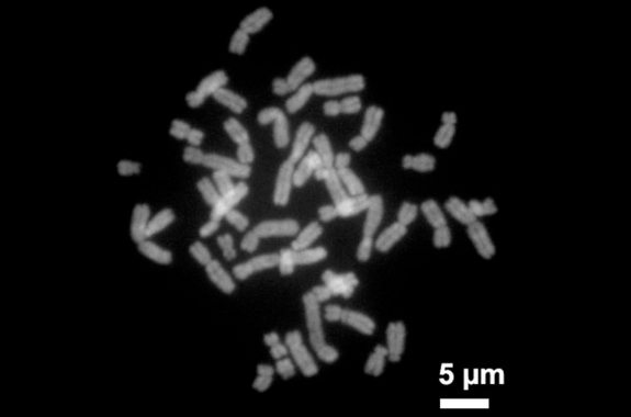 a black and white microscope image on a 5 micron scale that shows chromosomes