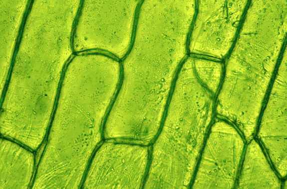 Plant cell through microscope.