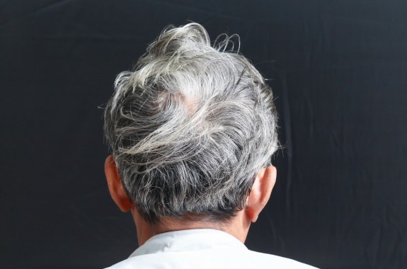 looking at the back of an old persons head filled with mostly white and some grey hair, against a black background