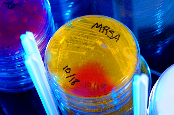 various petri dishes in stacks under blue light. in the center of the image is a stack of yellow glowing plates. the top one reads "mrsa 10/18"