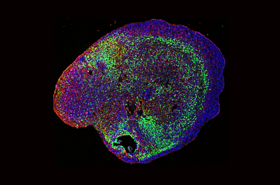 A cross-section of a brain-shaped cluster of cells