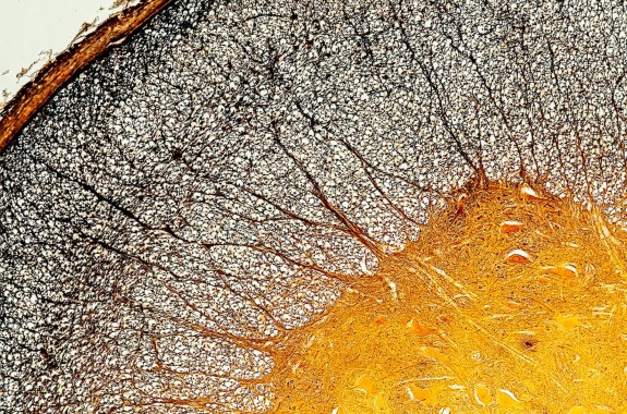 A magnified image of a quarter-circle filled with white cells. Closer to the center, the cells appear larger and yellow.