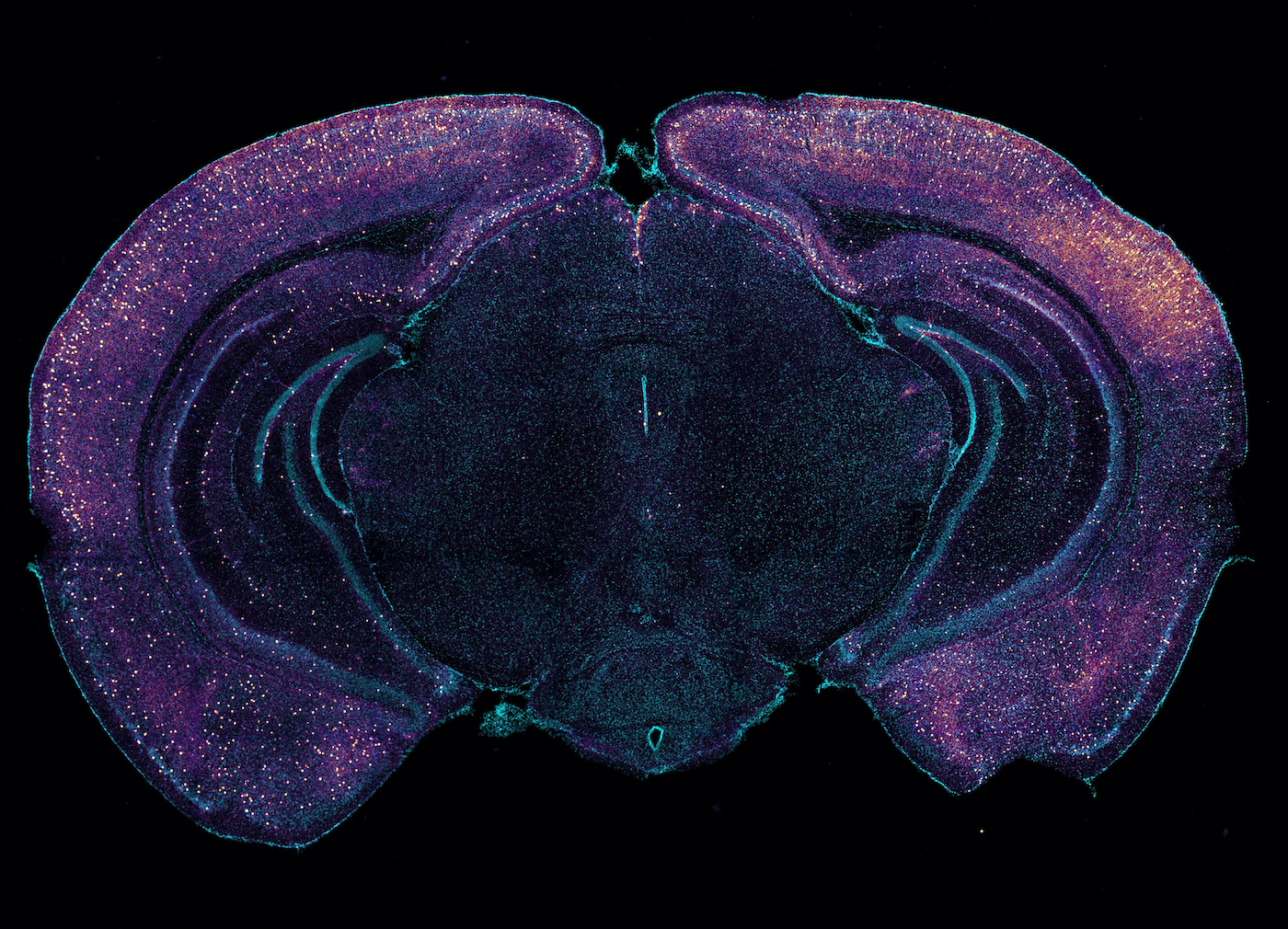A cross section of a mouse brain covered with bright purple and blue pinprick dots