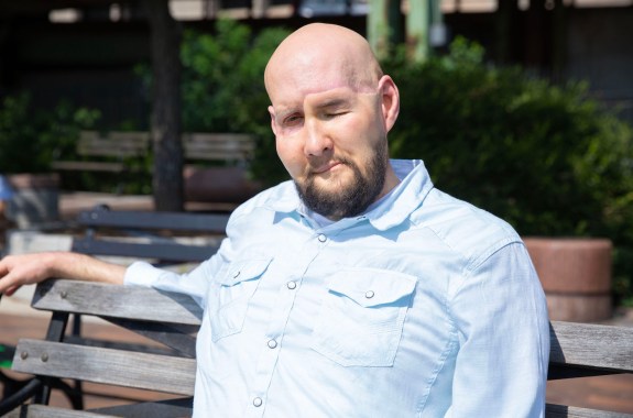 A man sitting on a bench, with one eye closed.
