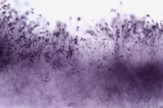 thin strands of fungus as seen through a microscope