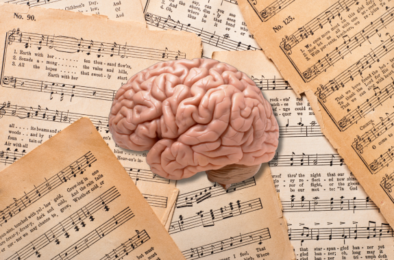 An image of a human brain overlaid over sheet music