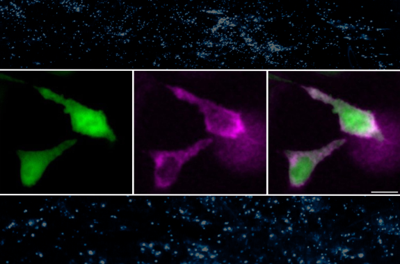 Three blobs of colors, on the left, two green blobs. in the center, two pink blobs. On the right, two green and pink blobs.