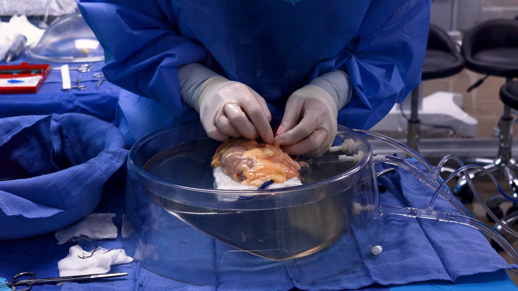 A person touches an organ inside a plastic dish, which is attached to tubes.