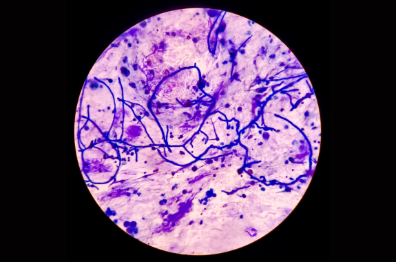 Yeast fungi underneath a microscope