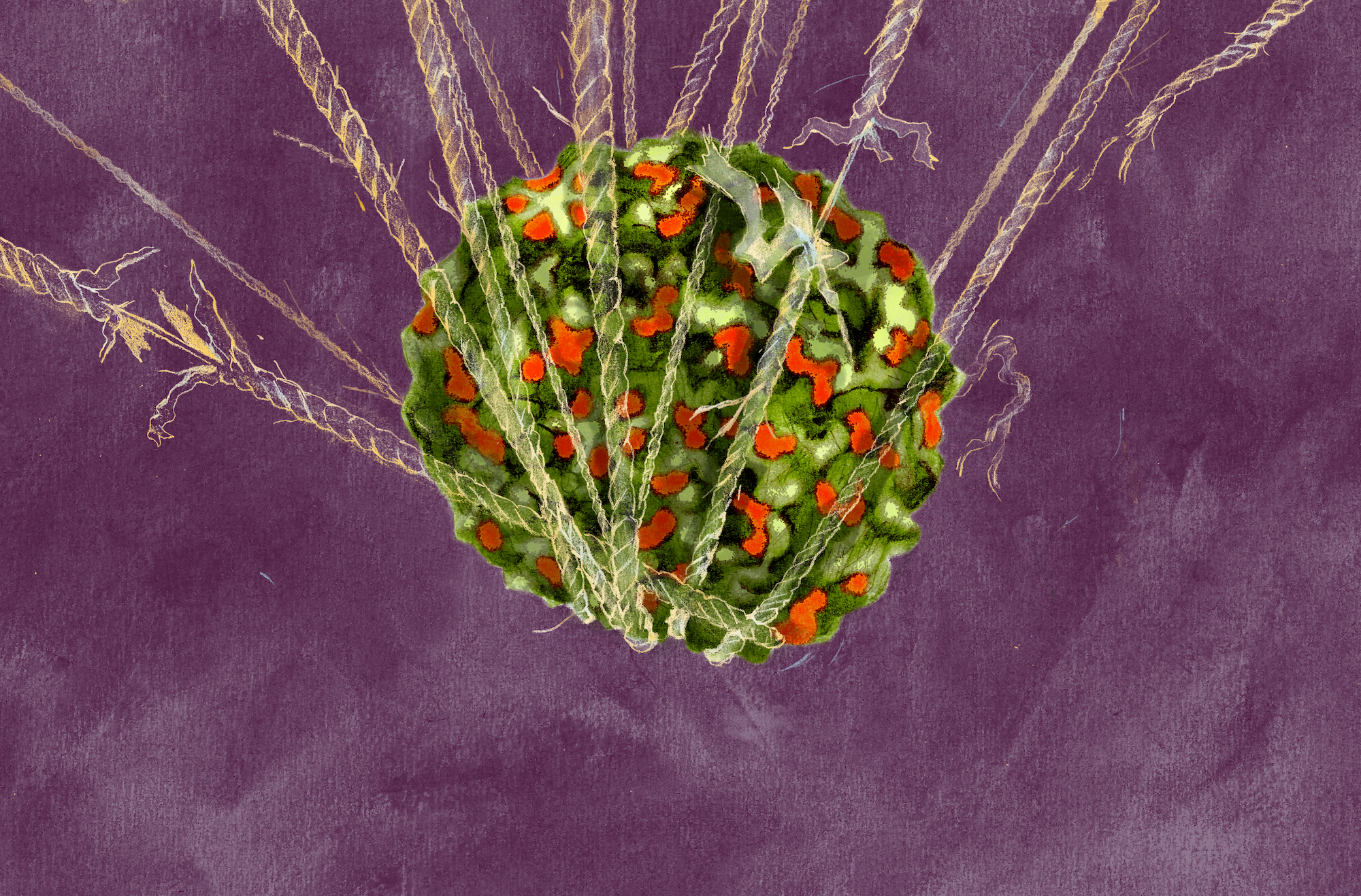 An illustration of the "new polio" virus (AFM) being held together by ropes, which are fraying and falling apart under its weight.