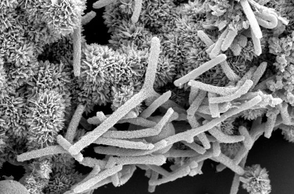 Grayscale image of fluffy-looking scaled balls at the upper left, with tube-like structures coating them along the lower right surface.